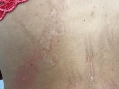 Marcas dos aoites nas costas da mulher (Foto: Polcia Civil/Divulgao)