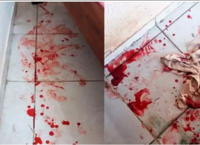 Sangue ficou espalhado por onde o cachorro passou (Foto: arquivo pessoal)