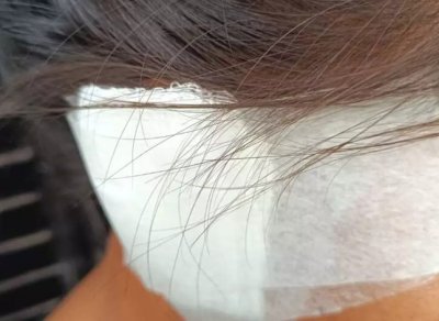 V�tima mostra curativo ap�s ter orelha cortada pelo companheiro. (Foto: Osvaldo Duarte/Dourados News)