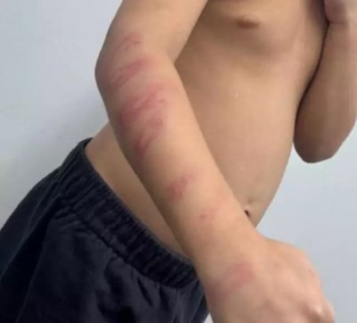 Bra�o machucado ap�s surra (Foto: Direto das Ruas)